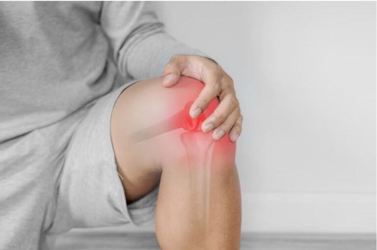 Say Goodbye to Knee Pain: 10 Effective Home Remedies You Must Try Today!